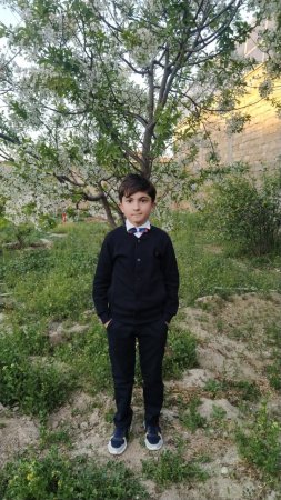 Bu uşaqların həyatda qalması möcüzə ola bilər! Bir bacı, bir qardaş nələr yaşayır?! Bu uşaqların həyatda qalması möcüzə ola bilər! Bir bacı, bir qardaş nələr yaşayır?!