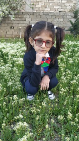 Bu uşaqların həyatda qalması möcüzə ola bilər! Bir bacı, bir qardaş nələr yaşayır?! Bu uşaqların həyatda qalması möcüzə ola bilər! Bir bacı, bir qardaş nələr yaşayır?!